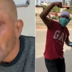 Zihinseli Engelli Selçuk Demir Sosyal Medyada Tanınan Şahıs, Başka Birinin Aile