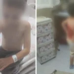 Arnavutköy’de akran şiddeti: 12 yaşındaki çocuğu kolonya döküp ateşe verdiler