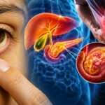 Gözlerde Sararma Hangi Hastalığın Belirtisi? Uzmanından Uyarı