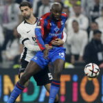 Beşiktaş’tan Ümit Akdağ Açıklaması: Sağ Elinde Kırık Tespit Edildi