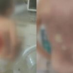Arnavutköy’de akran şiddeti: 12 yaşındaki çocuğu kolonya döküp yaktılar