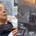 Kayseri’de Evinde Oturan Kadının Üzerine Tavan Çöktü: 75 Yaşındaki F.Ö. Görme Kaybı