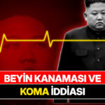 Kim Jong-un Beyin Kanamasıyla Komaya Girdi, Çin’e Göroldü
